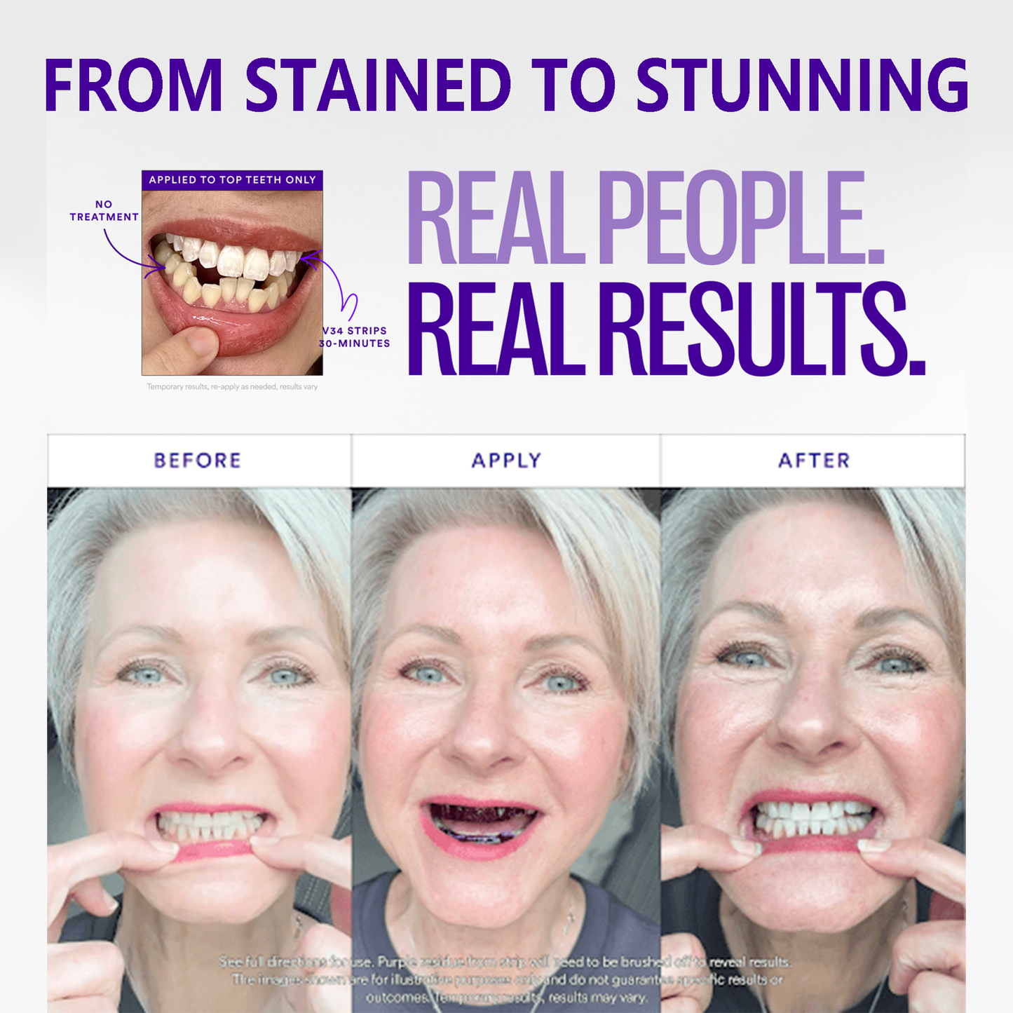 🦷Yagoo™ V36 Whitening Strips – Professional Teeth Whitening at Home(UPGRADED VERSION)