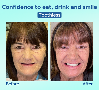 🌎Ends Today: 70% OFF!⏰Tiworld® Premium Denture🍀AdaptableFit Functional Dentures🦷Obtain American Dental Association (ADA) Certification