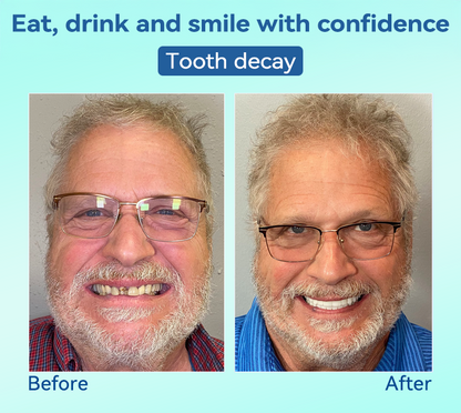 🌎Ends Today: 70% OFF!⏰Tiworld® Premium Denture🍀AdaptableFit Functional Dentures🦷Obtain American Dental Association (ADA) Certification