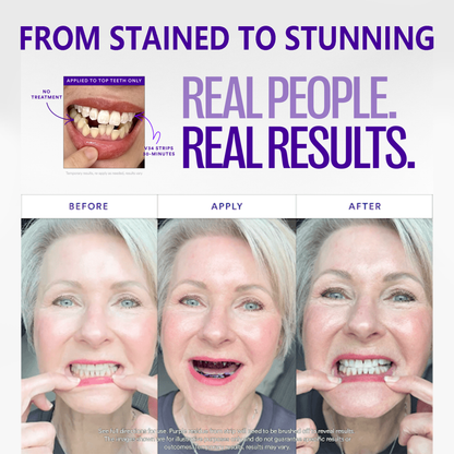 🦷Yagoo™ V36 Whitening Strips – Professional Teeth Whitening at Home(UPGRADED VERSION)