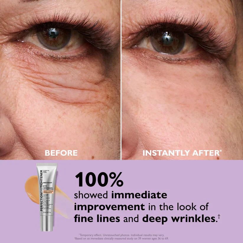 Last Chance! 70% OFF 🔥 Instant Eye Tightener – Smooth Formula + Free Brush Included!