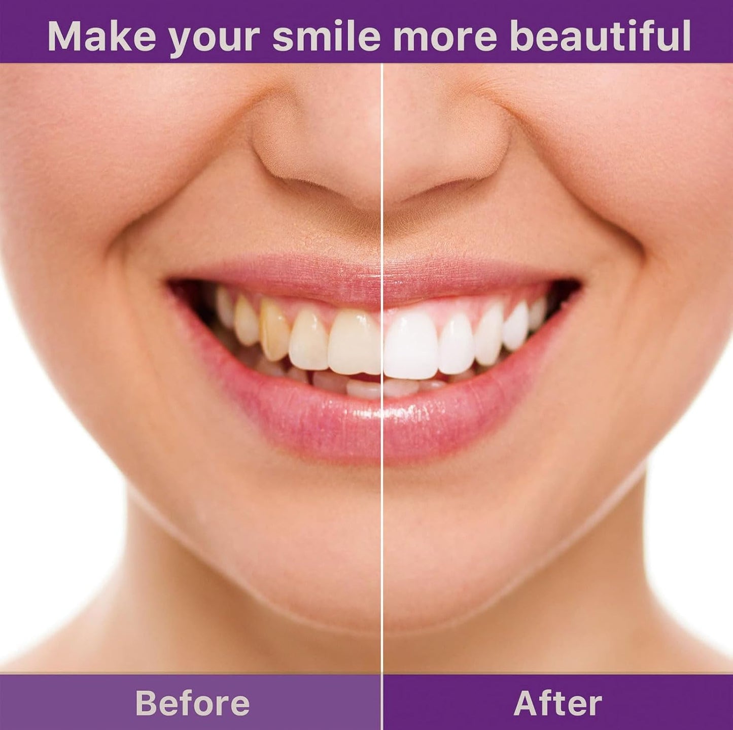🦷Yagoo™ V36 Whitening Strips – Professional Teeth Whitening at Home(UPGRADED VERSION)