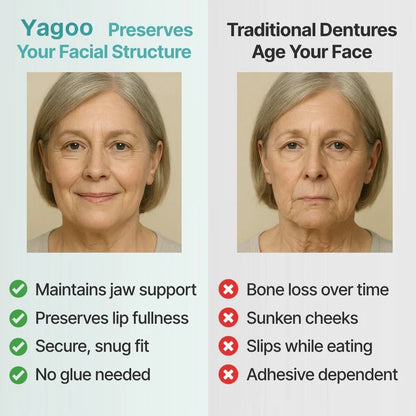 🌎Ends Today: 70% OFF! ⏰Yagoo™ Medical Full Denture with Strong Suctiond🦷Obtain American Dental Association (ADA) Certification
