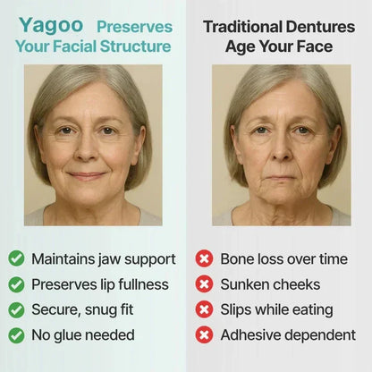 Ends Today: 70% OFF! ⏰Yagoo™ Medical Full Denture with Strong Suctiond🦷Obtain American Dental Association (ADA) Certification